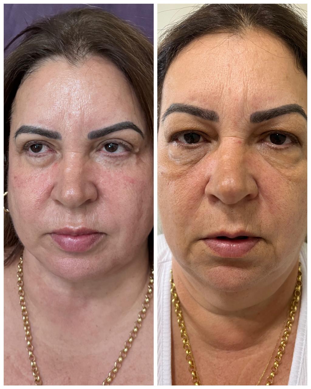 WhatsApp Image 2026-03-27 at 15.53.35